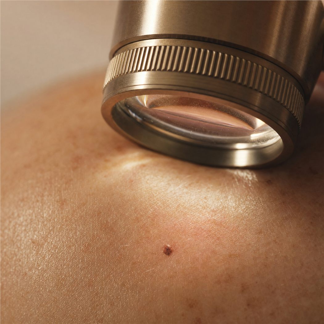 Dermatologia estetyczna i konsultacje zmian skórnych